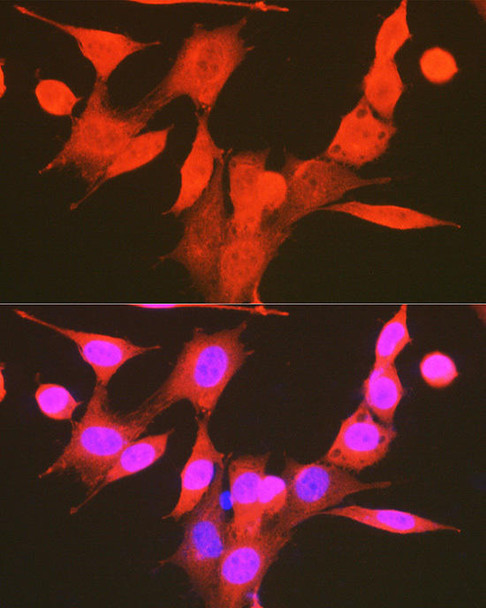 Epigenetics and Nuclear Signaling Antibodies 4 Anti-Phospho-PDK1-S241 Antibody CABP0477