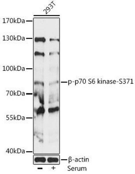 Cell Death Antibodies 2 Anti-Phospho-P70S6K1-S371 Antibody CABP0482