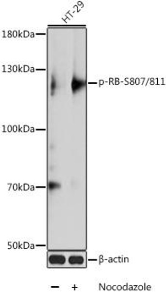 Cell Cycle Antibodies 2 Anti-Phospho-Rb-S807/811 Antibody CABP0484
