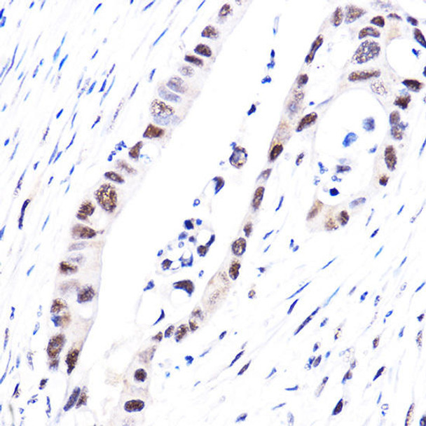 Epigenetics and Nuclear Signaling Antibodies 4 Anti-Phospho-YAP1-S127 Antibody CABP0489