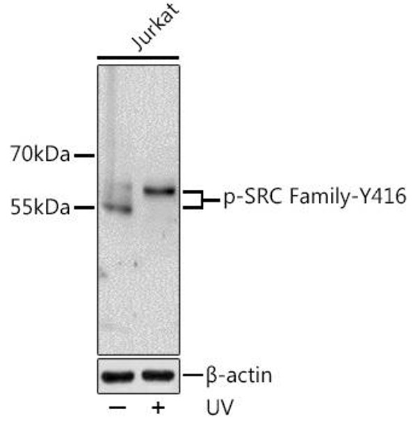 Cell Biology Antibodies 16 Anti-Phospho-Lck-Y416/FYN-Y416 Antibody CABP0491