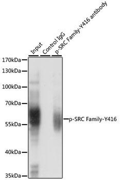 Cell Biology Antibodies 16 Anti-Phospho-Lck-Y416/FYN-Y416 Antibody CABP0491