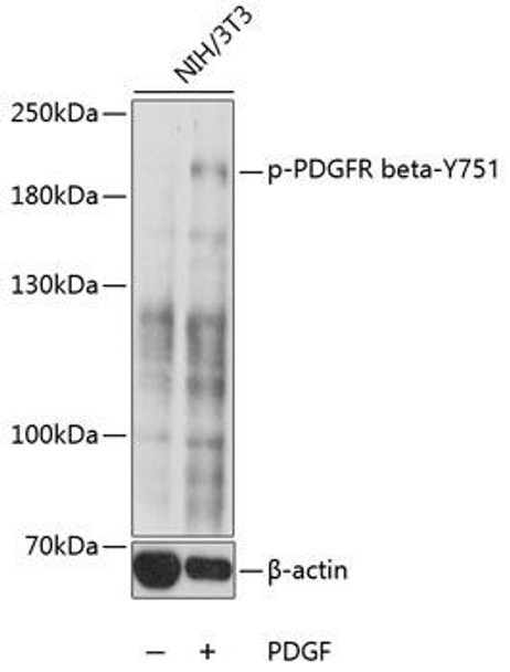 Cell Biology Antibodies 16 Anti-Phospho-PDGFRb-Y751 Antibody CABP0493