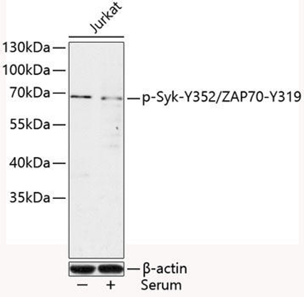Cell Biology Antibodies 16 Anti-Phospho-Syk-Y352/ZAP70-Y319 Antibody CABP0501