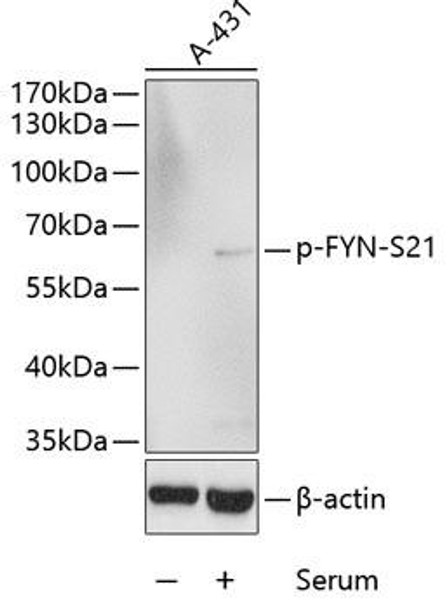 Immunology Antibodies 3 Anti-Phospho-FYN-S21 Antibody CABP0510