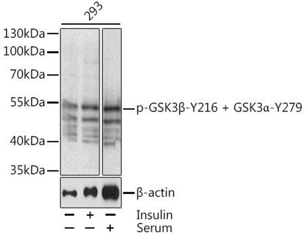 Cell Biology Antibodies 16 Anti-Phospho-GSK3B-Y216 Antibody CABP0512