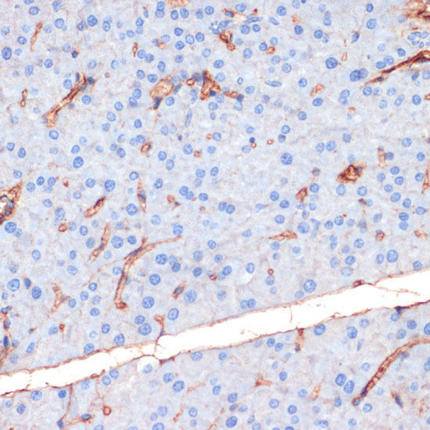 Cell Biology Antibodies 16 Anti-Phospho-eNOS-S1177 Antibody CABP0515