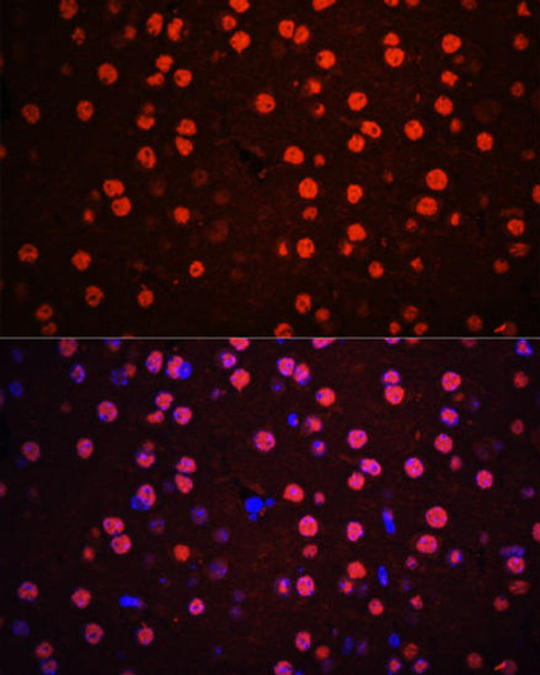 Cell Death Antibodies 2 Anti-Phospho-MAPK14-T180/Y182 Antibody CABP0526