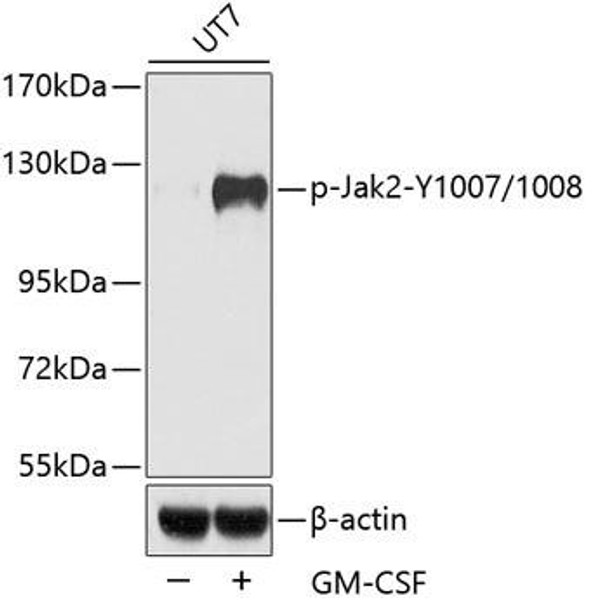 Immunology Antibodies 3 Anti-Phospho-Jak2-Y1007/1008 Antibody CABP0531