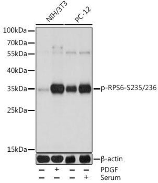 Cell Biology Antibodies 16 Anti-Phospho-RPS6-S235/236 Antibody CABP0538
