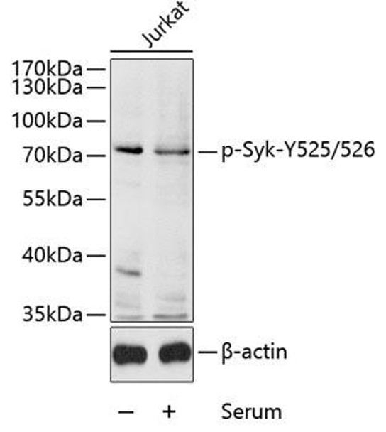 Immunology Antibodies 3 Anti-Phospho-Syk-Y525/526 Antibody CABP0542