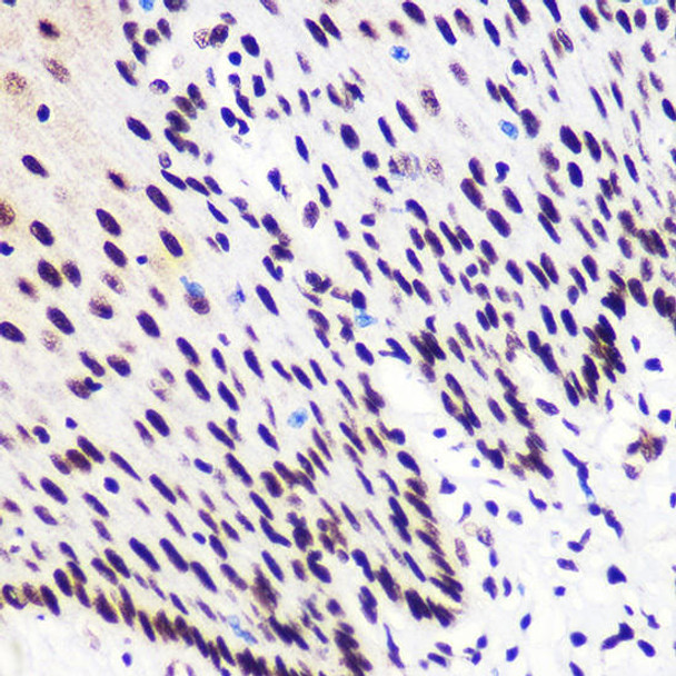 Cell Biology Antibodies 16 Anti-Phospho-Smad2-S465/467 Smad3-S423/425 Antibody CABP0548