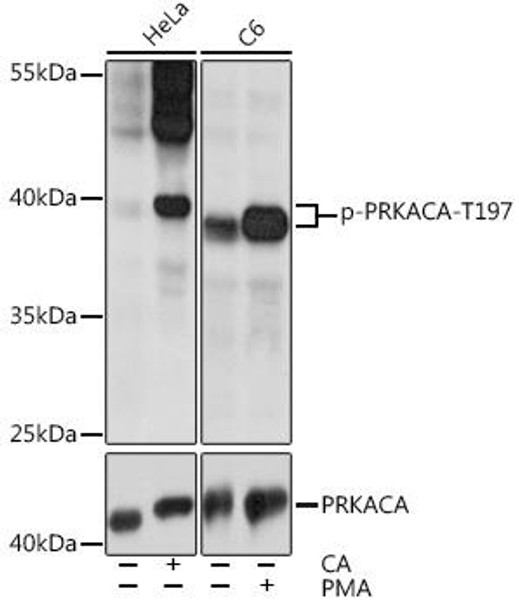 Cell Biology Antibodies 16 Anti-Phospho-PRKACA-T197 Antibody CABP0557