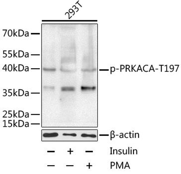 Cell Biology Antibodies 16 Anti-Phospho-PRKACA-T197 Antibody CABP0557