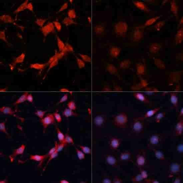 Cell Death Antibodies 2 Anti-Phospho-P70S6K1-T389 Antibody CABP0564