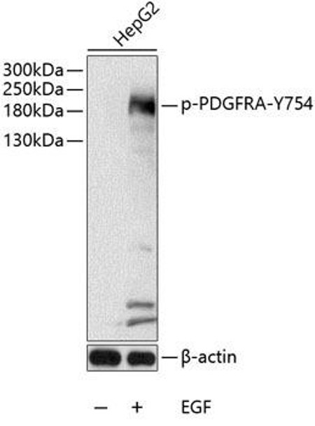 Cell Biology Antibodies 16 Anti-Phospho-PDGFRA-Y754 Antibody CABP0568