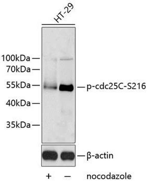 Cell Cycle Antibodies 2 Anti-Phospho-cdc25C-S216 Antibody CABP0577