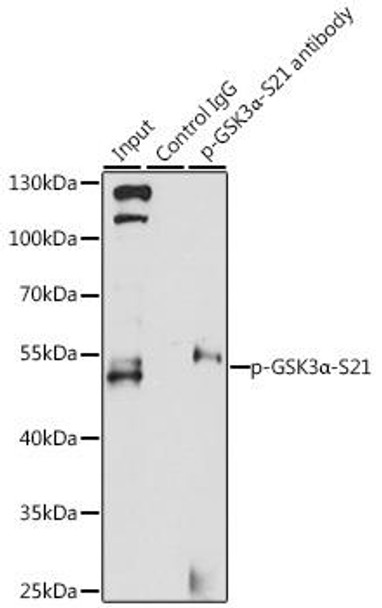 Metabolism Antibodies 3 Anti-Phospho-GSK3A-S21 Antibody CABP0582