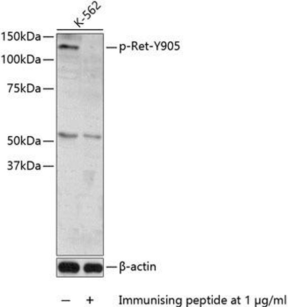 Cell Biology Antibodies 16 Anti-Phospho-Ret-Y905 Antibody CABP0600