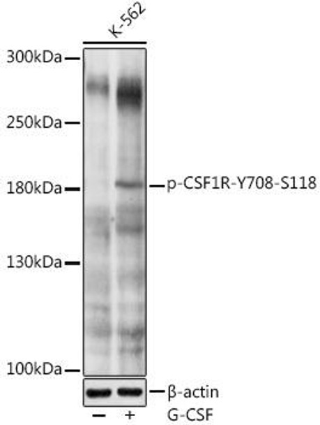 Immunology Antibodies 3 Anti-Phospho-CSF1R-Y708 Antibody CABP0609