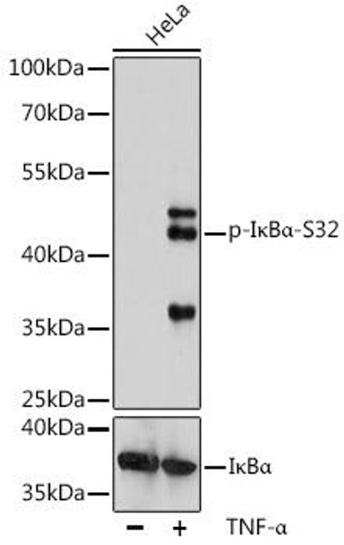 Immunology Antibodies 3 Anti-Phospho-NFKBIA-S32 Antibody CABP0731