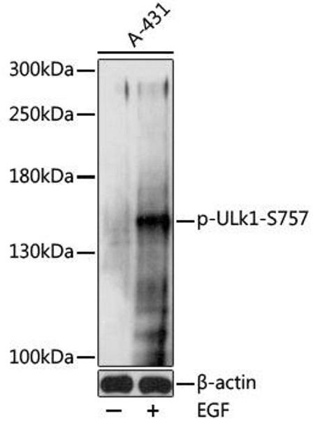 Autophagy Antibodies Anti-Phospho-ULk1-S757 Antibody CABP0736