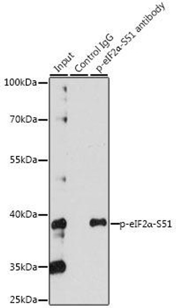 Metabolism Antibodies 3 Anti-Phospho-eIF2alpha-S51 Antibody CABP0745