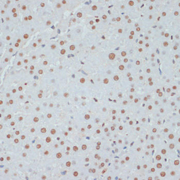 Cell Death Antibodies 2 Anti-Phospho-TP53-S33 pAb Antibody CABP0762