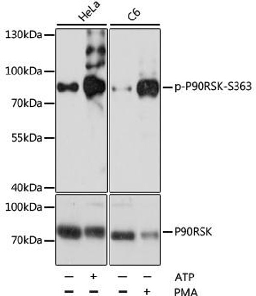 Cell Cycle Antibodies 2 Anti-Phospho-P90RSK-S363 pAb Antibody CABP0767