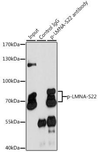 Cell Biology Antibodies 16 Anti-Phospho-LMNA-S22 pAb Antibody CABP0777