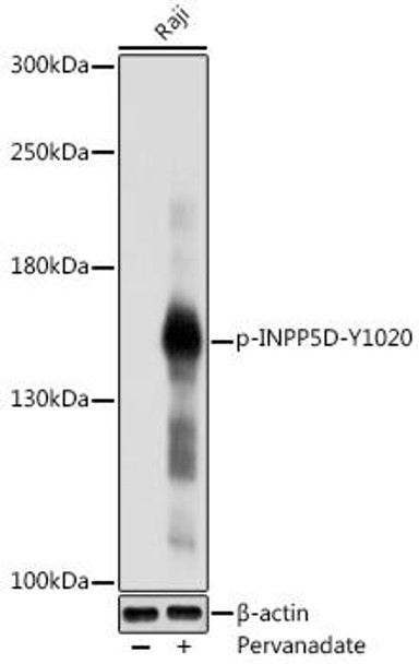 Cell Death Antibodies 2 Anti-Phospho-INPP5D-Y1020 pAb Antibody CABP0778