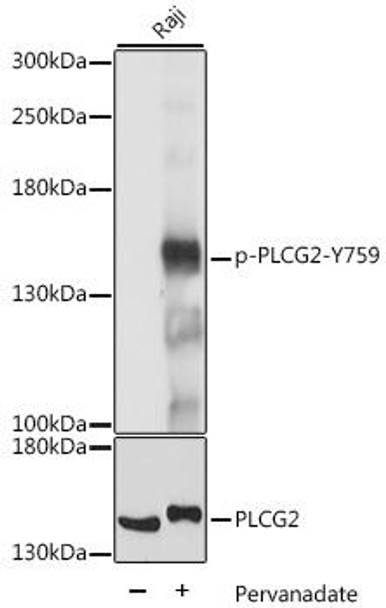 Metabolism Antibodies 3 Anti-Phospho-PLCG2-Y759 pAb Antibody CABP0785