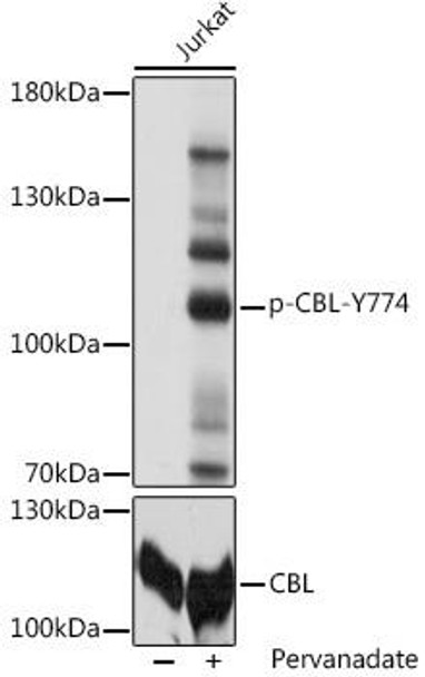 Signal Transduction Antibodies 3 Anti-Phospho-CBL-Y774 pAb Antibody CABP0794