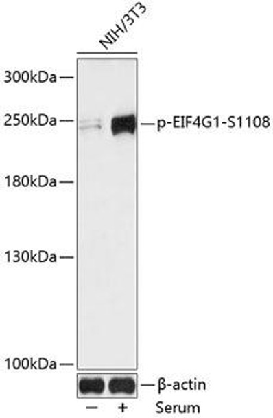 Immunology Antibodies 3 Anti-Phospho-EIF4G1-S1108 pAb Antibody CABP0796