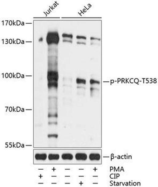 Immunology Antibodies 3 Anti-Phospho-PRKCQ-T538 pAb Antibody CABP0798