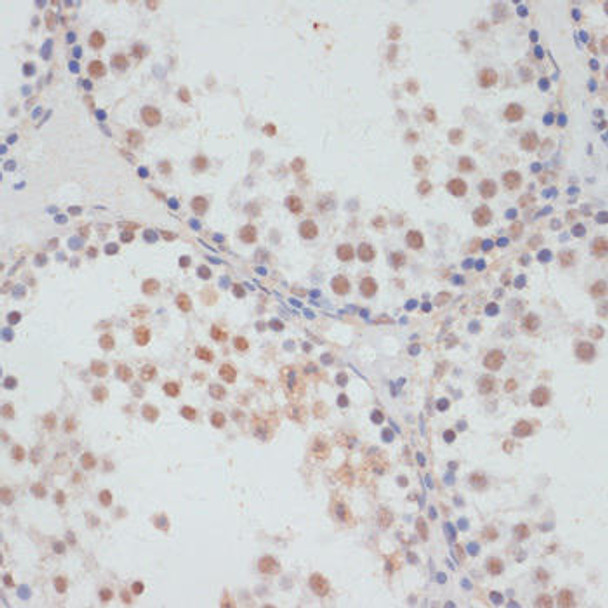 Immunology Antibodies 3 Anti-Phospho-RPS6KA5-S376 pAb Antibody CABP0800