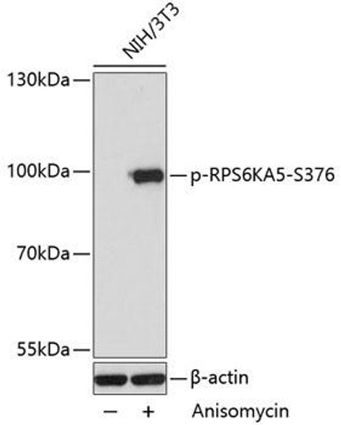 Immunology Antibodies 3 Anti-Phospho-RPS6KA5-S376 pAb Antibody CABP0800