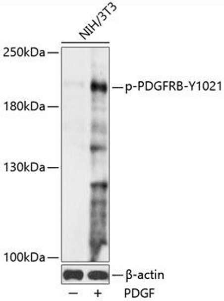 Cell Biology Antibodies 16 Anti-Phospho-PDGFRB-Y1021 pAb Antibody CABP0815