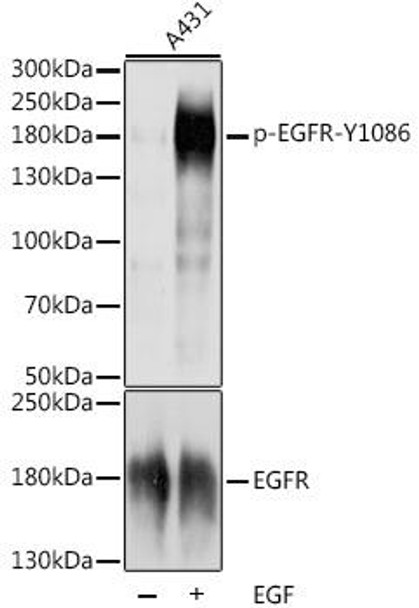 Immunology Antibodies 3 Anti-Phospho-EGFR-Y1086 pAb Antibody CABP0820