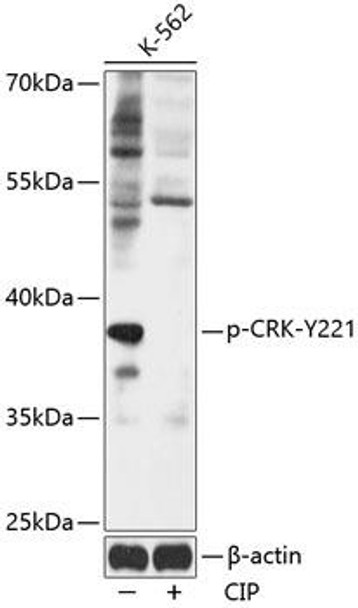 Cell Biology Antibodies 16 Anti-Phospho-CRK-Y221 pAb Antibody CABP0822