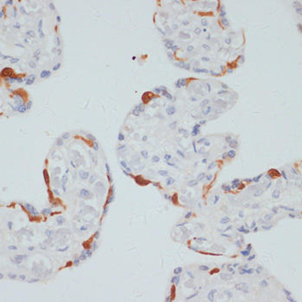 Immunology Antibodies 3 Anti-Phospho-PLCG1-S1248 pAb Antibody CABP0827