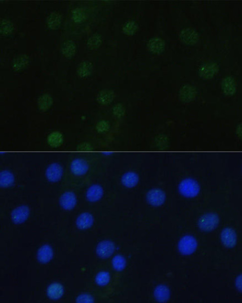 Epigenetics and Nuclear Signaling Antibodies 4 Anti-Phospho-Histone H3-S28 pAb Antibody CABP0839