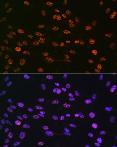 Epigenetics and Nuclear Signaling Antibodies 4 Anti-Phospho-Histone H3-S10 pAb Antibody CABP0840