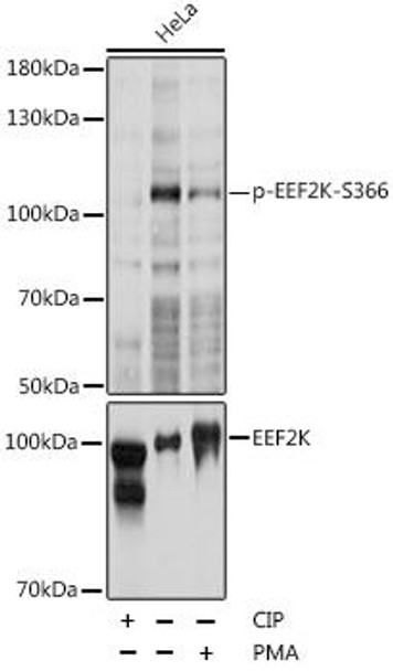 Cell Biology Antibodies 16 Anti-Phospho-EEF2K-S366 pAb Antibody CABP0845