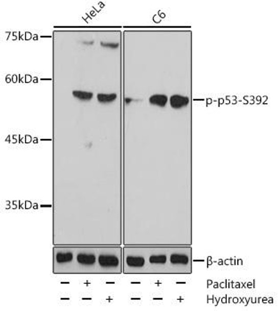 Cell Death Antibodies 2 Anti-Phospho-TP53-S392 pAb Antibody CABP0860