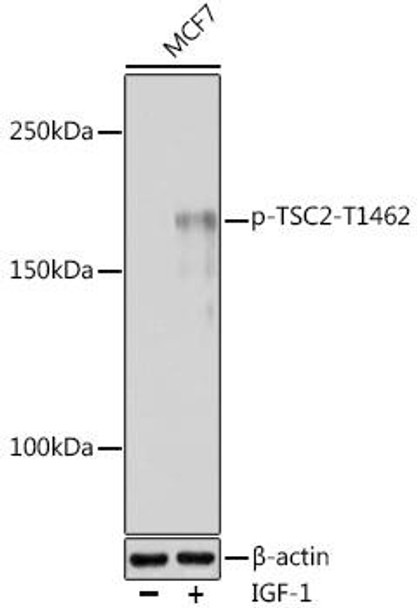 Immunology Antibodies 3 Anti-Phospho-TSC2-T1462 pAb Antibody CABP0866