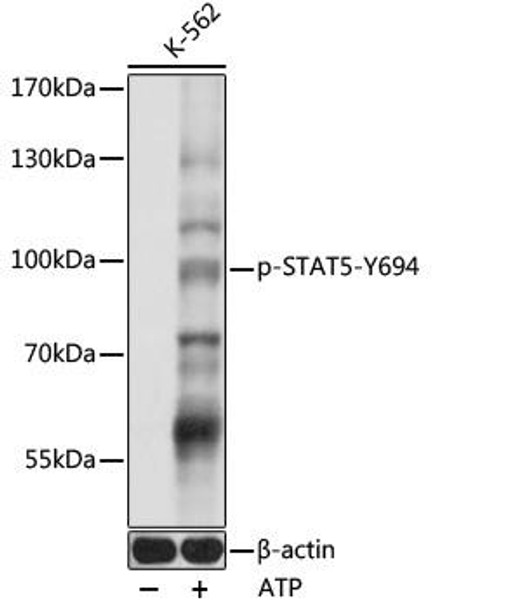 Cell Biology Antibodies 16 Anti-Phospho-STAT5-Y694 pAb Antibody CABP0887