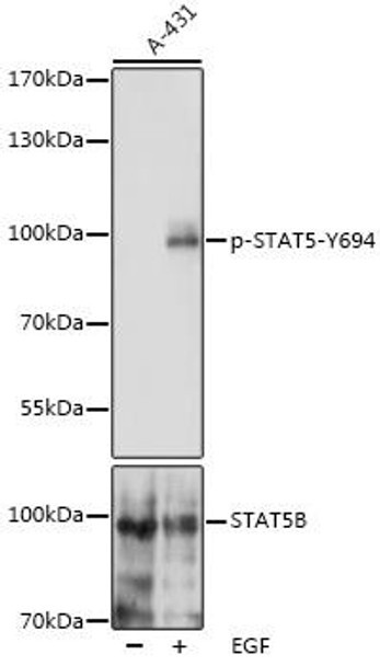 Cell Biology Antibodies 16 Anti-Phospho-STAT5-Y694 pAb Antibody CABP0887