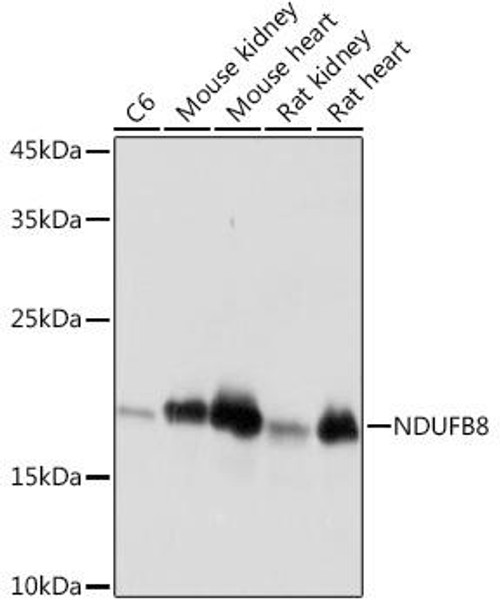 Metabolism Antibodies 3 Anti-NDUFB8 Monoclonal Antibody CAB19732
