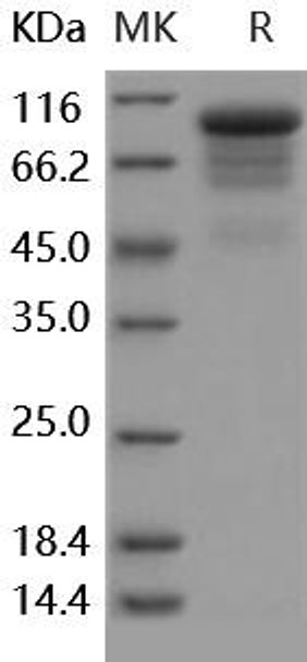 Human G-CSFR/CD114 Recombinant Protein  (RPES0111)